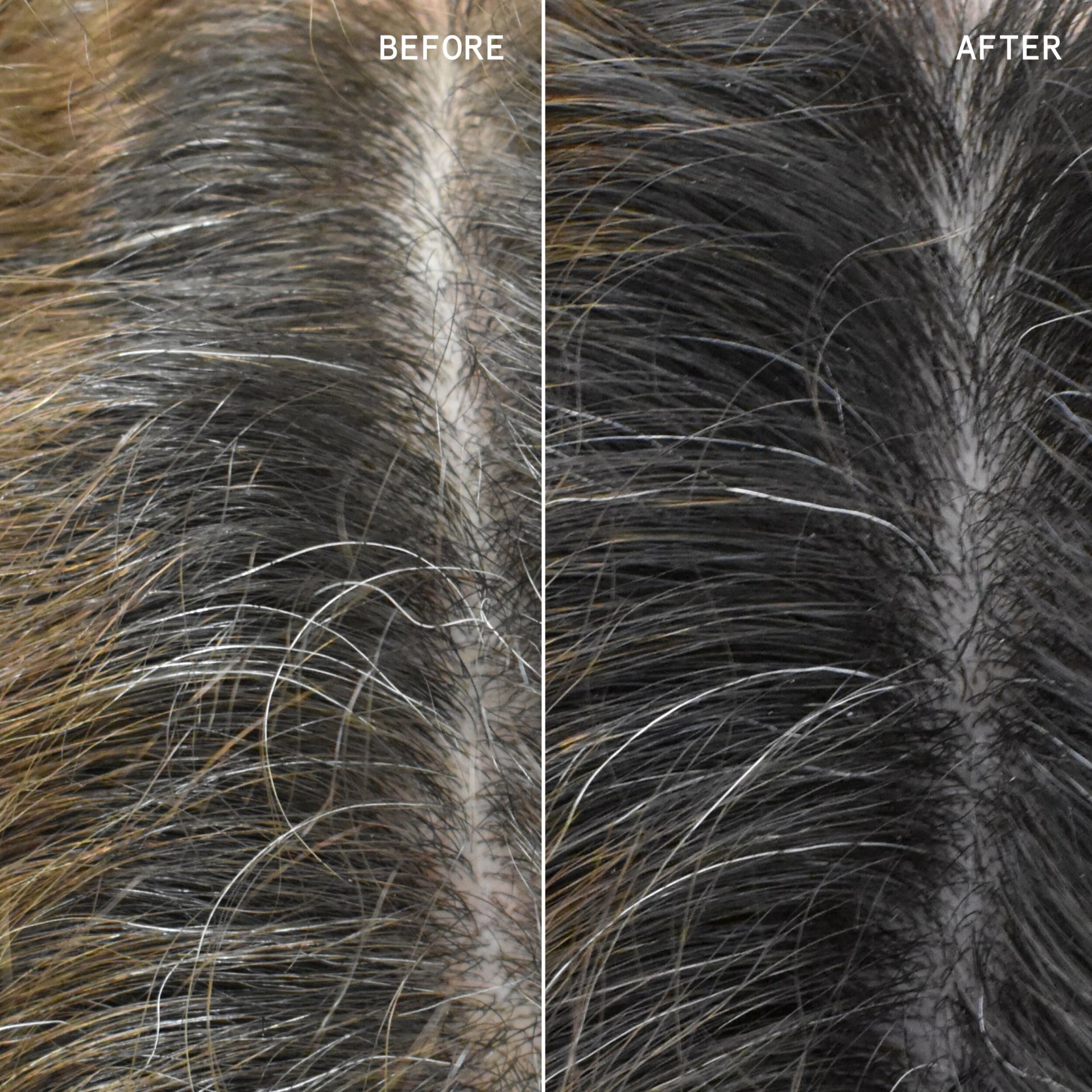 Youthbomb Scalp Serum B&A