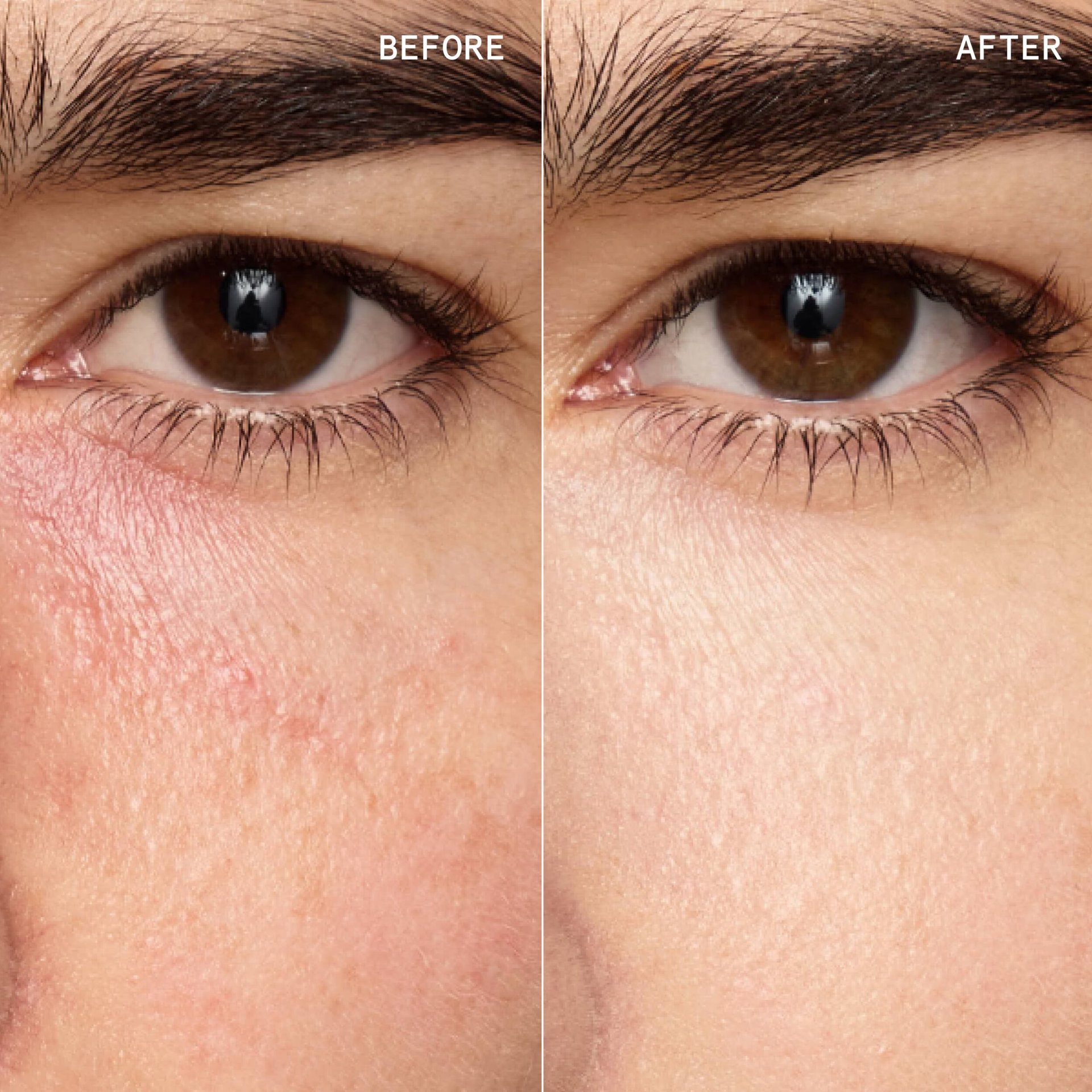 EVERYDAY_GREAT_SKIN_HYALURONIC_BLUR_CONCEALER
Shell