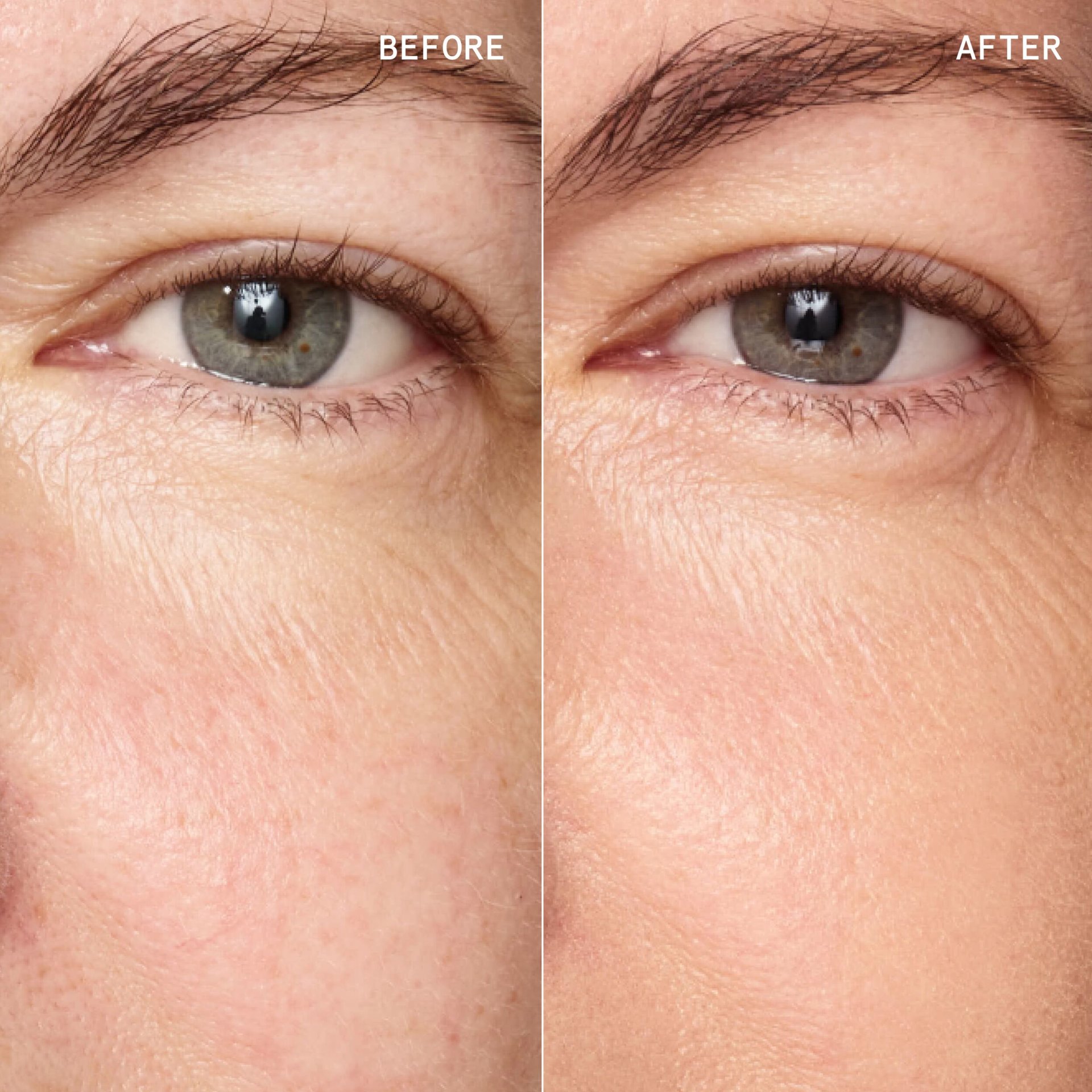 EVERYDAY_GREAT_SKIN_HYALURONIC_BLUR_CONCEALER
Beige