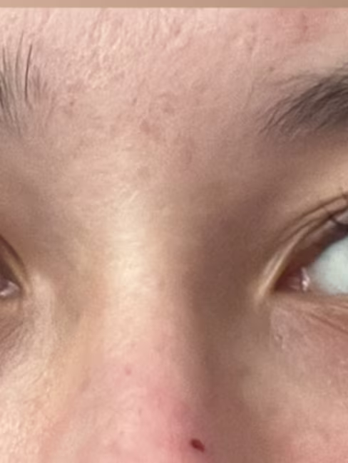 imagem da avaliação