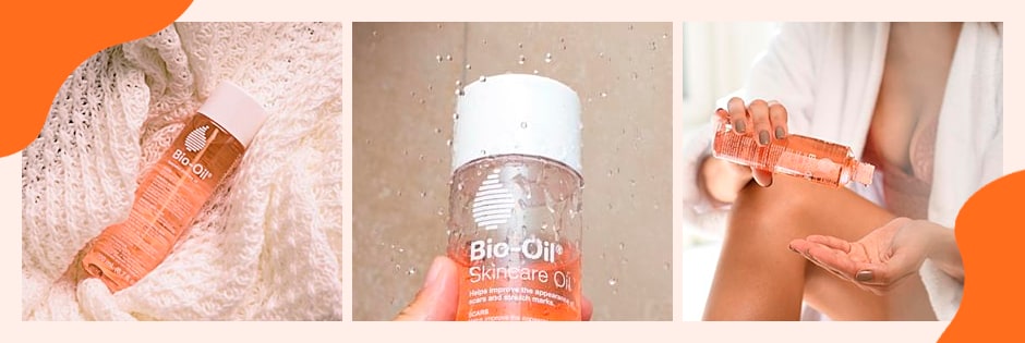 Tratamento Bio-Oil para Estrias