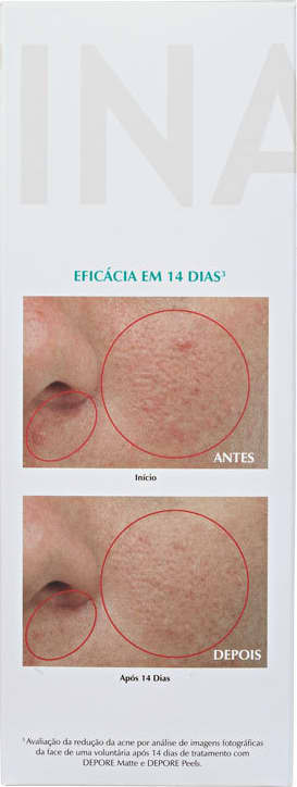 Ada Tina Depore Matte - Gel Matificante 60g