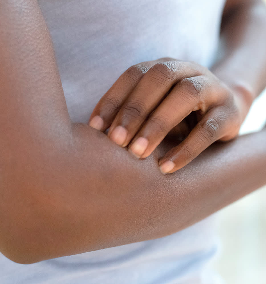 Dermatite atópica: como cuidar?