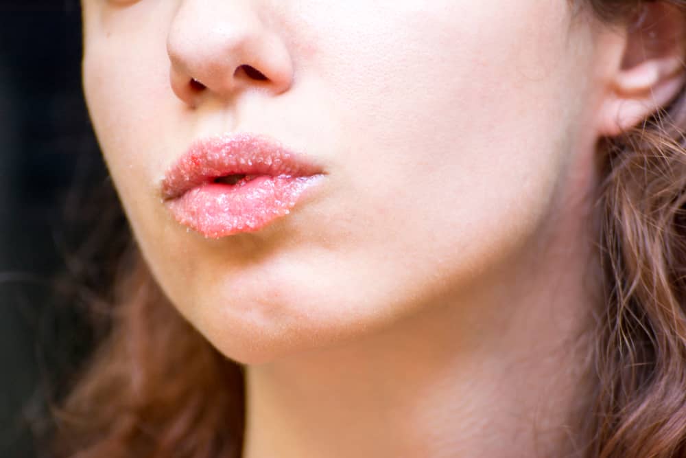 Imagem de boca com esfoliante labial