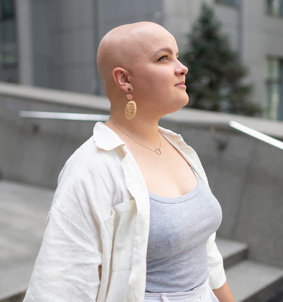 Cuidados com o couro cabeludo na calvície