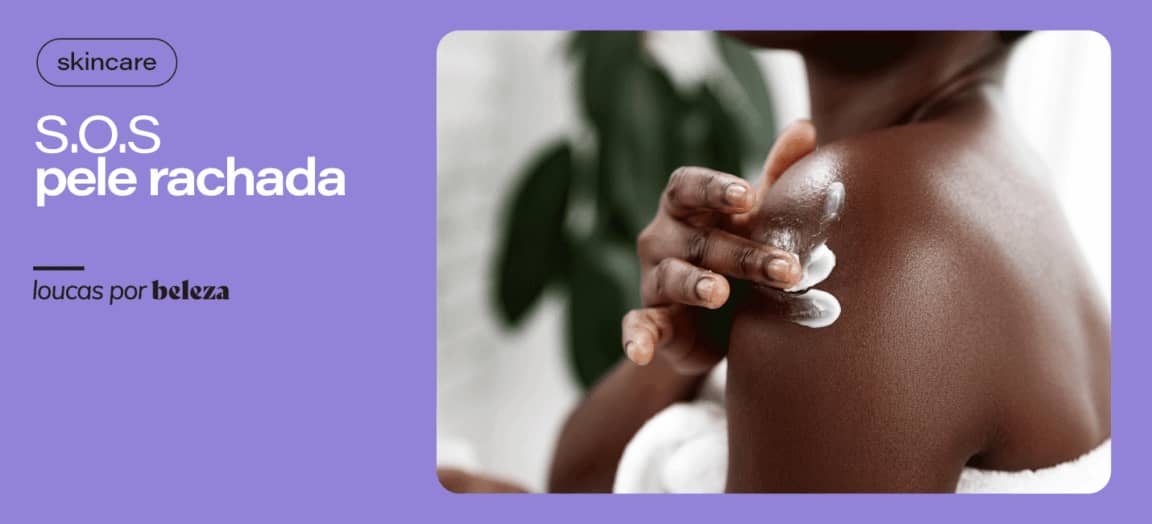 Como recuperar a pele rachada e o que causa as fissuras?