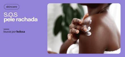 Como recuperar a pele rachada e o que causa as fissuras?