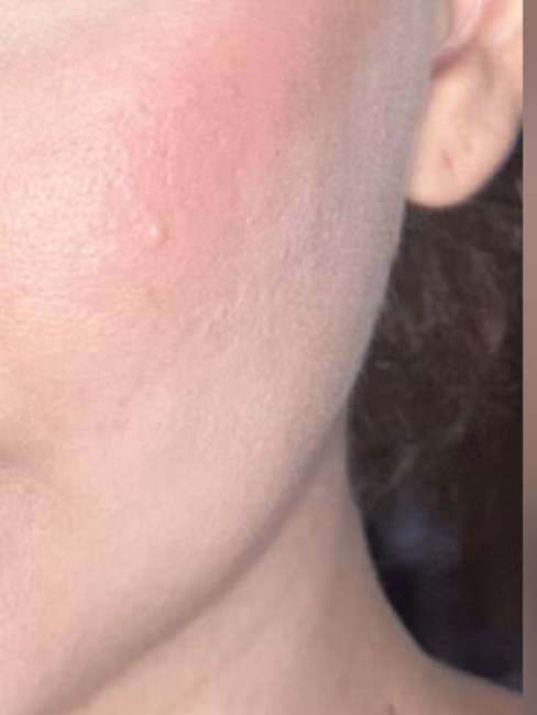 imagem da avaliação