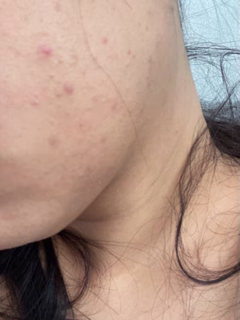 imagem da avaliação