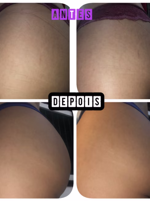 imagem da avaliação