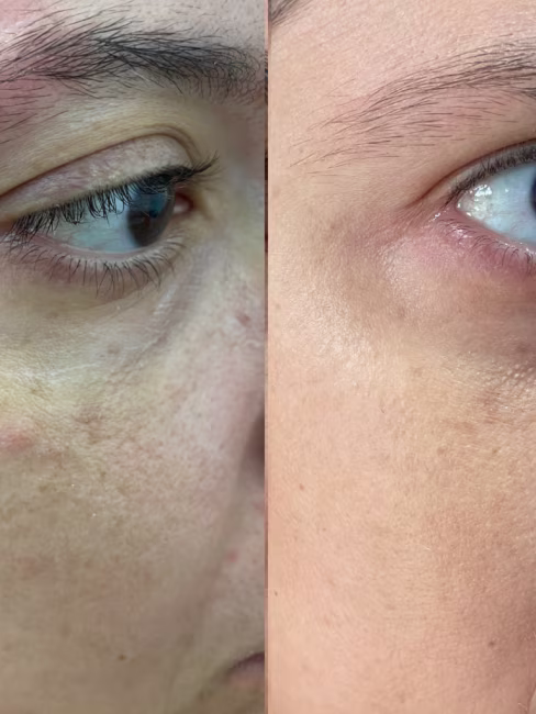 imagem da avaliação