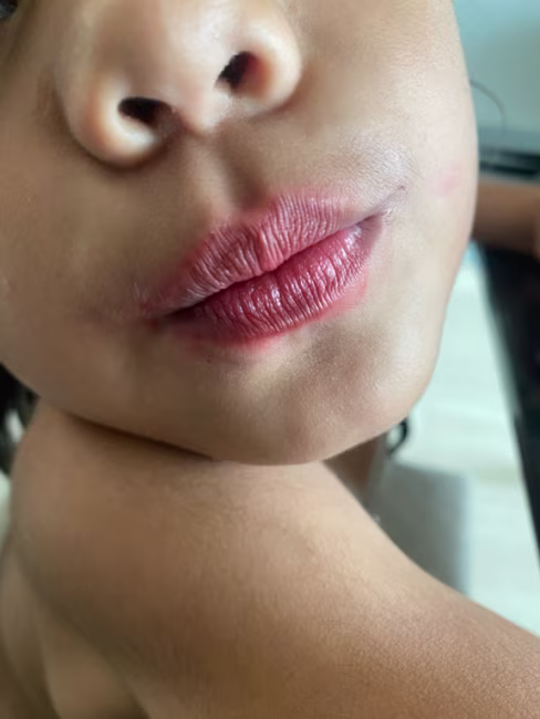 imagem da avaliação