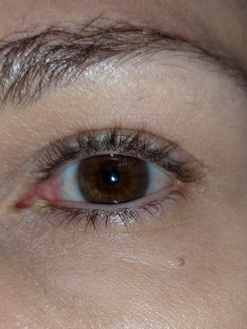 imagem da avaliação