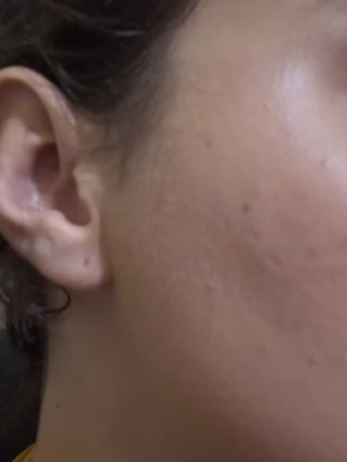 imagem da avaliação