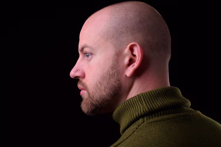 Barba para carecas: Homem branco, careca e de cabelo raspado na lateral, mostra a barba emendada. Ele usa blusa verde.
