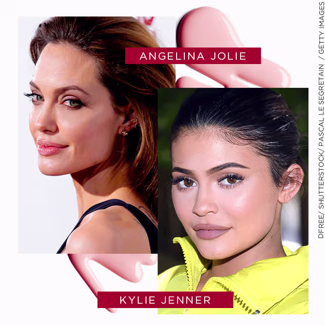 Celebridades que aderiram ao preenchimento labial