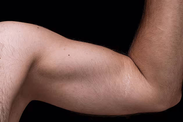 Foto mostra, em fundo preto, braço e axila de homem branco em destaque. A axila encontra-se depilada.