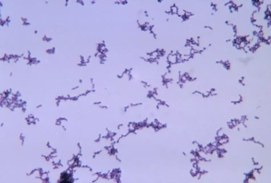 Imagem microscópica de Cutibacterium acnes cultivada em tioglicolato. Acumuladas, as bactérias formam estruturas que parecem filamentos escuros em fundo azul-claro.