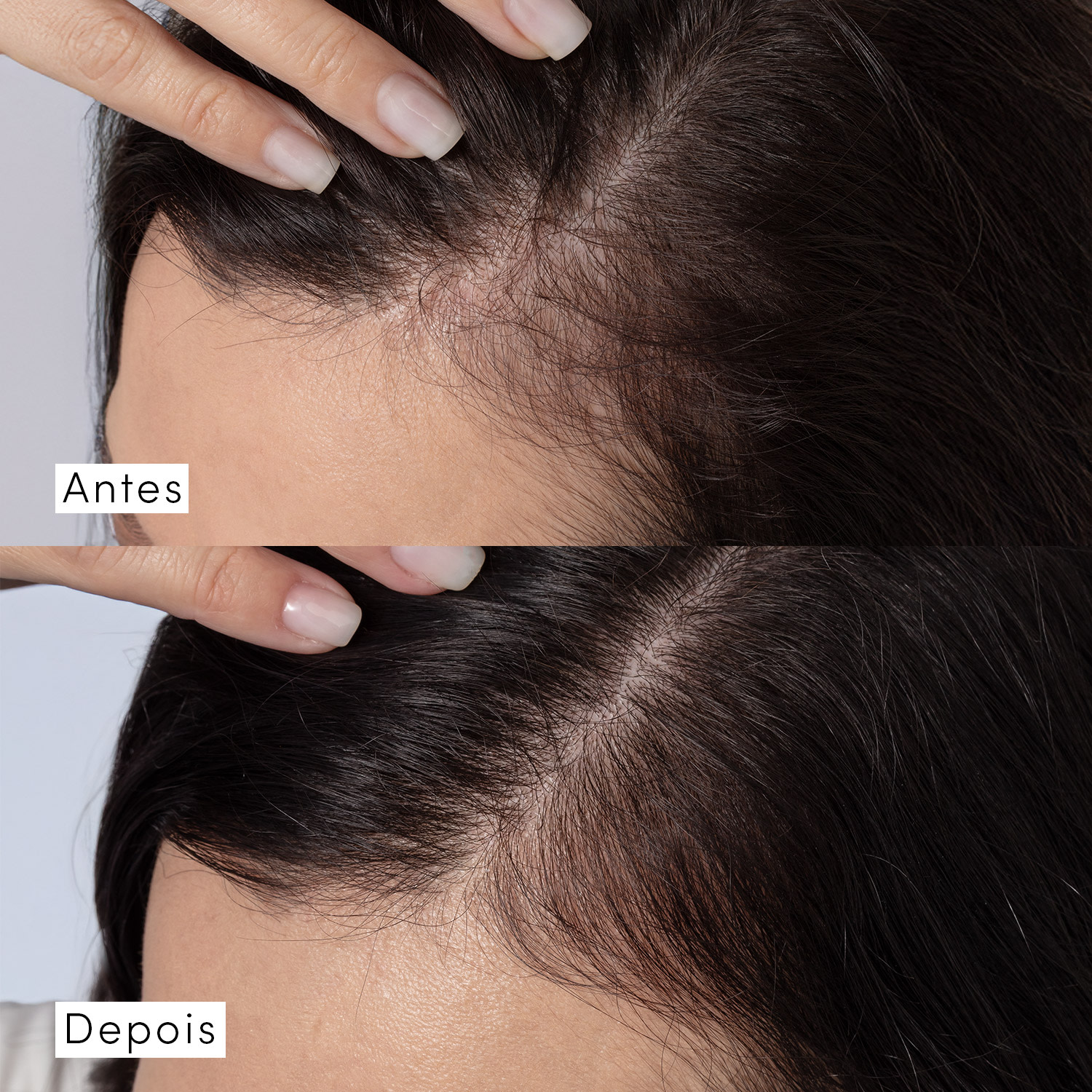 Shampoo Siàge Dermo Hair Resistência Antiqueda 300ml
