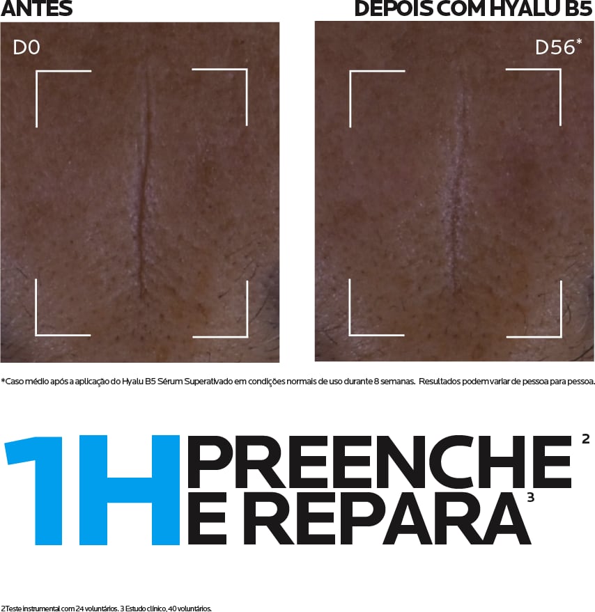 A imagem mostra o Sérum Redutor de Linhas Hyalu B5 de La Roche-Posay.