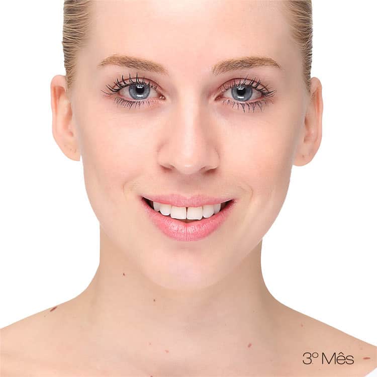 Ligia Kogos C+C Face - Sérum Anti- Idade 30ml
