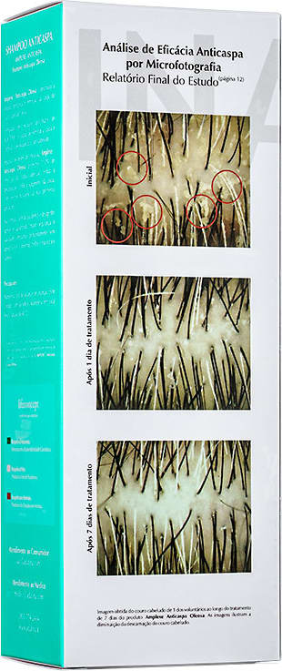 Ada Tina Amplexe Anticaspa Oleosa - Shampoo 200ml