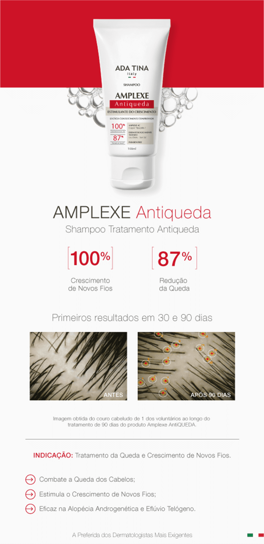 Ada Tina Amplexe - Shampoo Antiqueda 100ml