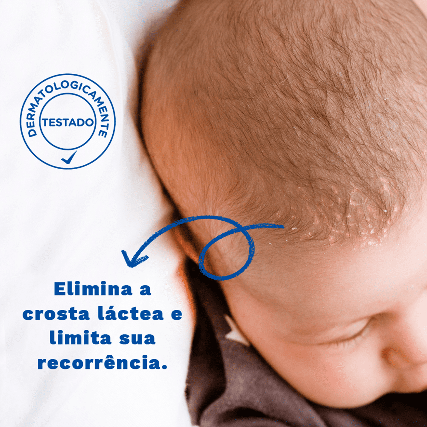 Creme Mustela Bebe Stelaker Crosta Lactea Beautybox