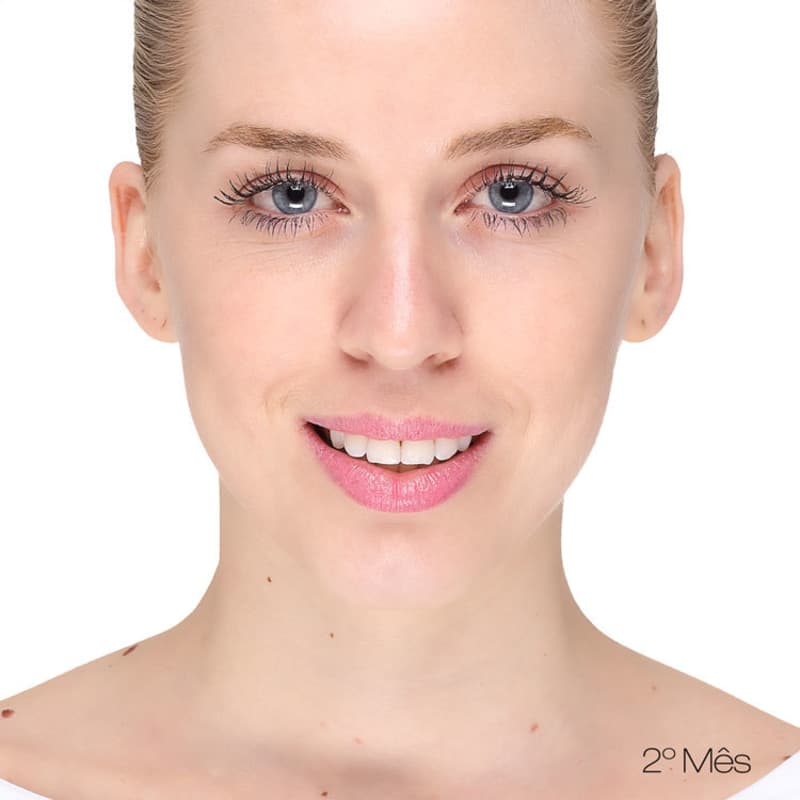 Ligia Kogos C+C Face - Sérum Anti- Idade 30ml
