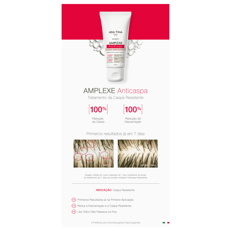 Ada Tina Amplexe Caspa Resistente - Shampoo Anticaspa 200ml