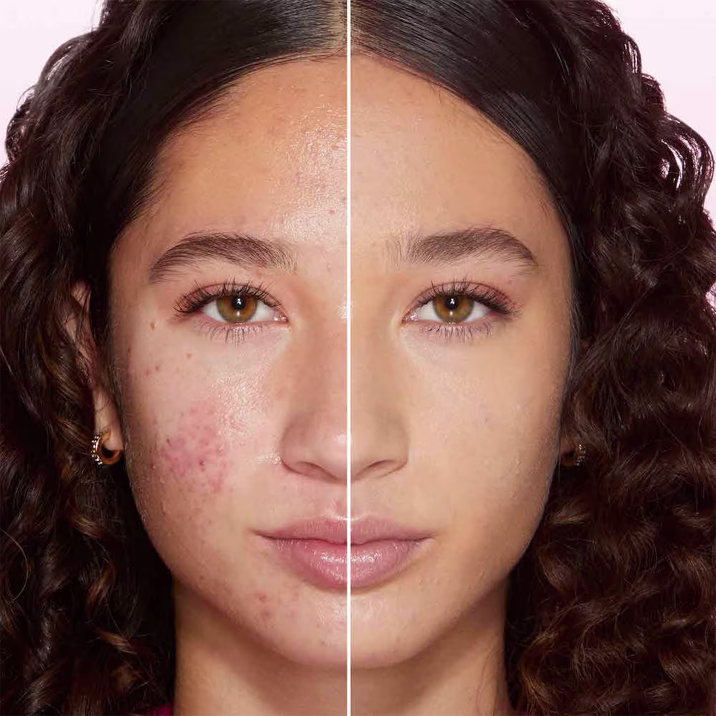 A imagem mostra o rosto de uma mulher, com uma linha dividindo o meio do rosto. Do lado esquerdo está sem base e do lado direito, ela está com base no rosto.