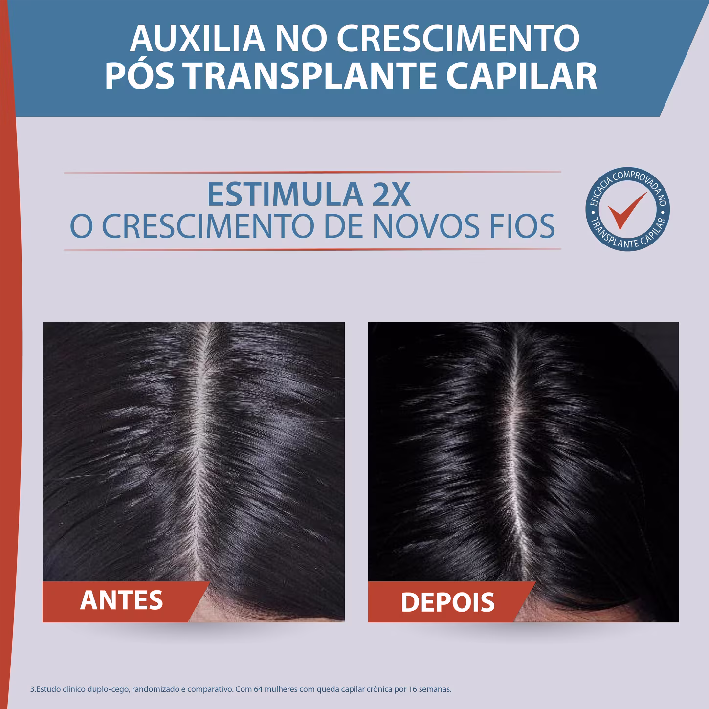 A imagem mostra comparativo de uso do sérum. A imagem de antes apresenta um couro cabelo mais vazio, já a imagem depois apresenta um couro cabeludo mais preenchido com fios saudáveis e brilhantes. Texto destaca que estimula 2x o crescimento de novos fios.