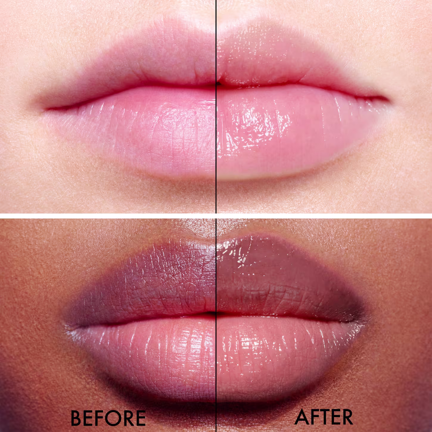 Antes e depois da aplicação do balm, sendo o depois com os lábios mais hidratados.