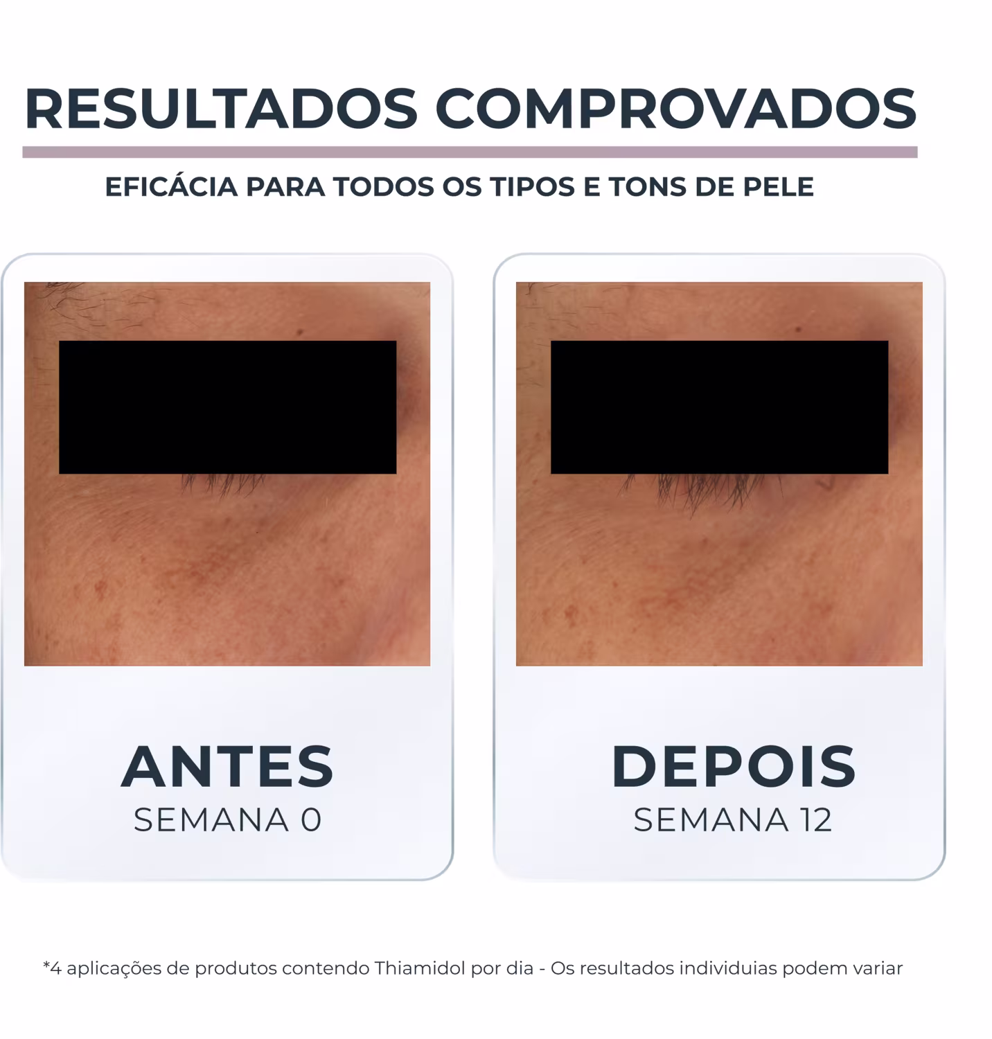 Creme para Área dos Olhos Eucerin Anti-Pigment, 15ml.