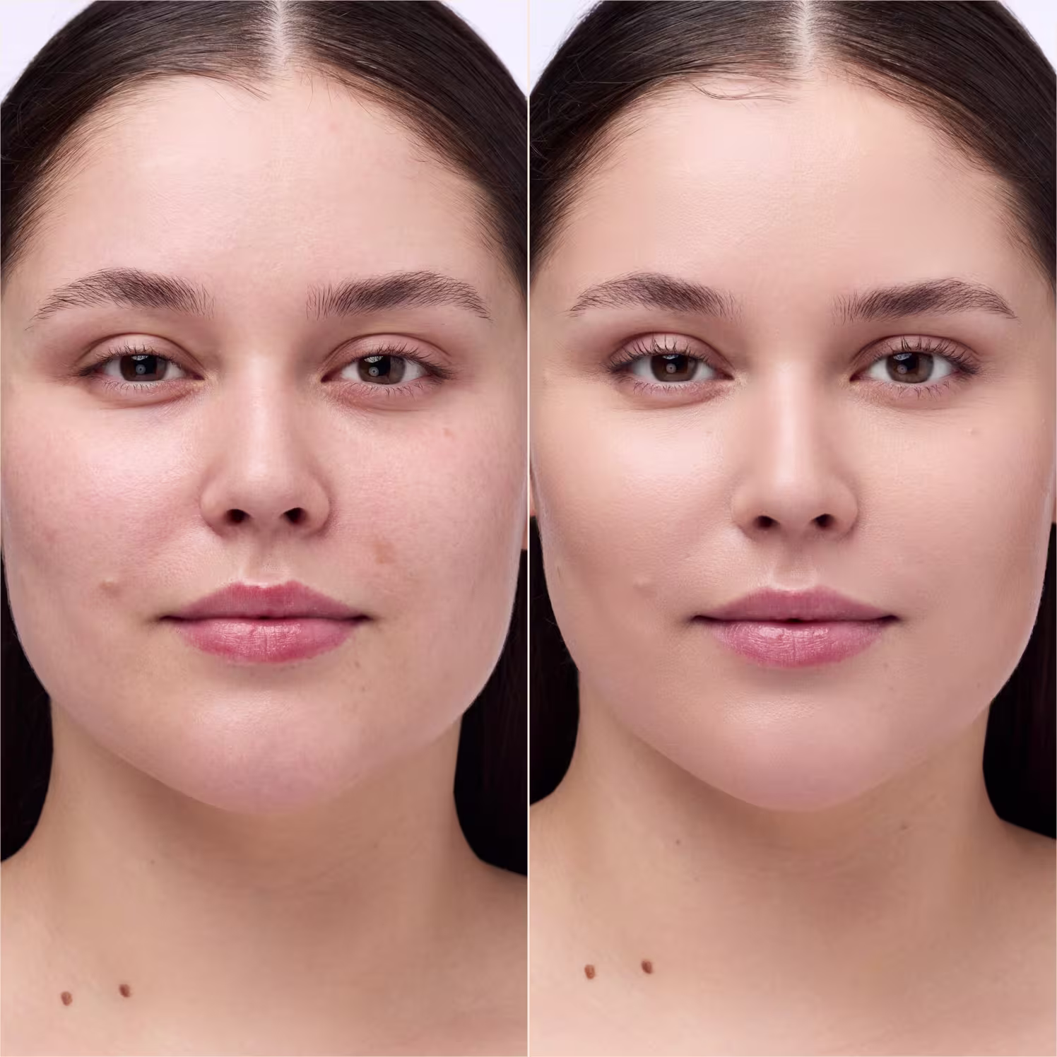 Imagem do antes e depois do uso do Corretivo Catrice Instant Bright Serum Concealer