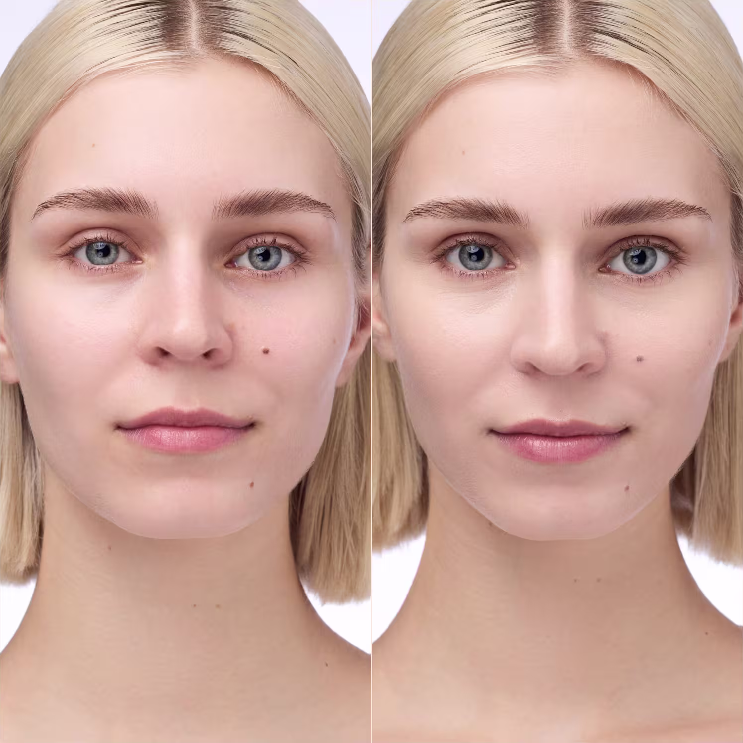 Imagem do antes e depois do uso do Corretivo Catrice Instant Bright Serum Concealer
