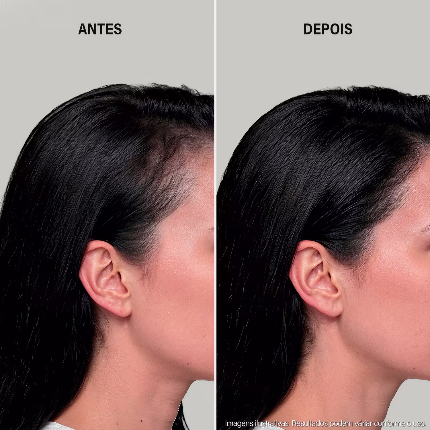Imagens ilustrativas de antes e depois do uso de um produto de tratamento capilar da marca Keune. Ambiente neutro, com foco no resultado do produto aplicado em cabelos escuros.