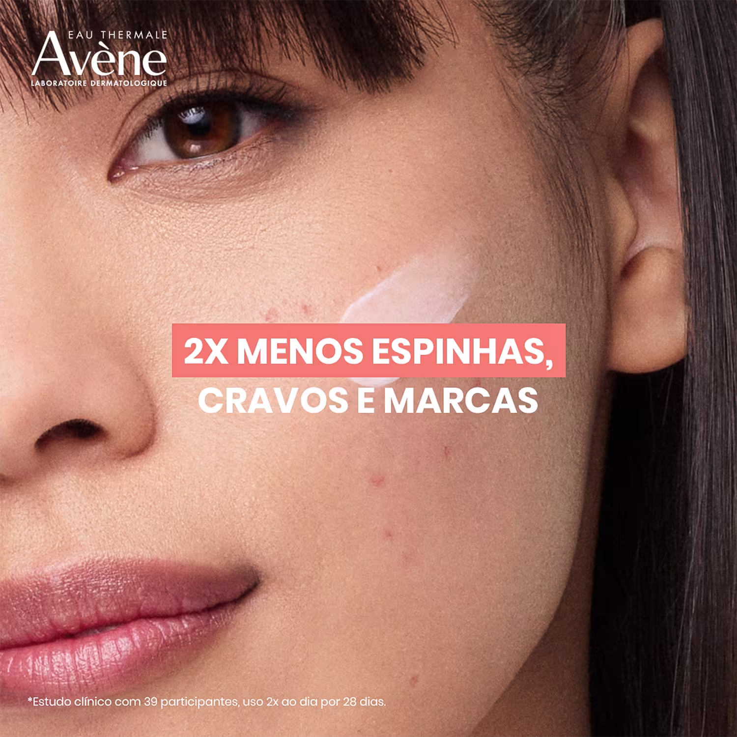 2X MENOS ESPINHAS, CRAVOS E MARCAS
