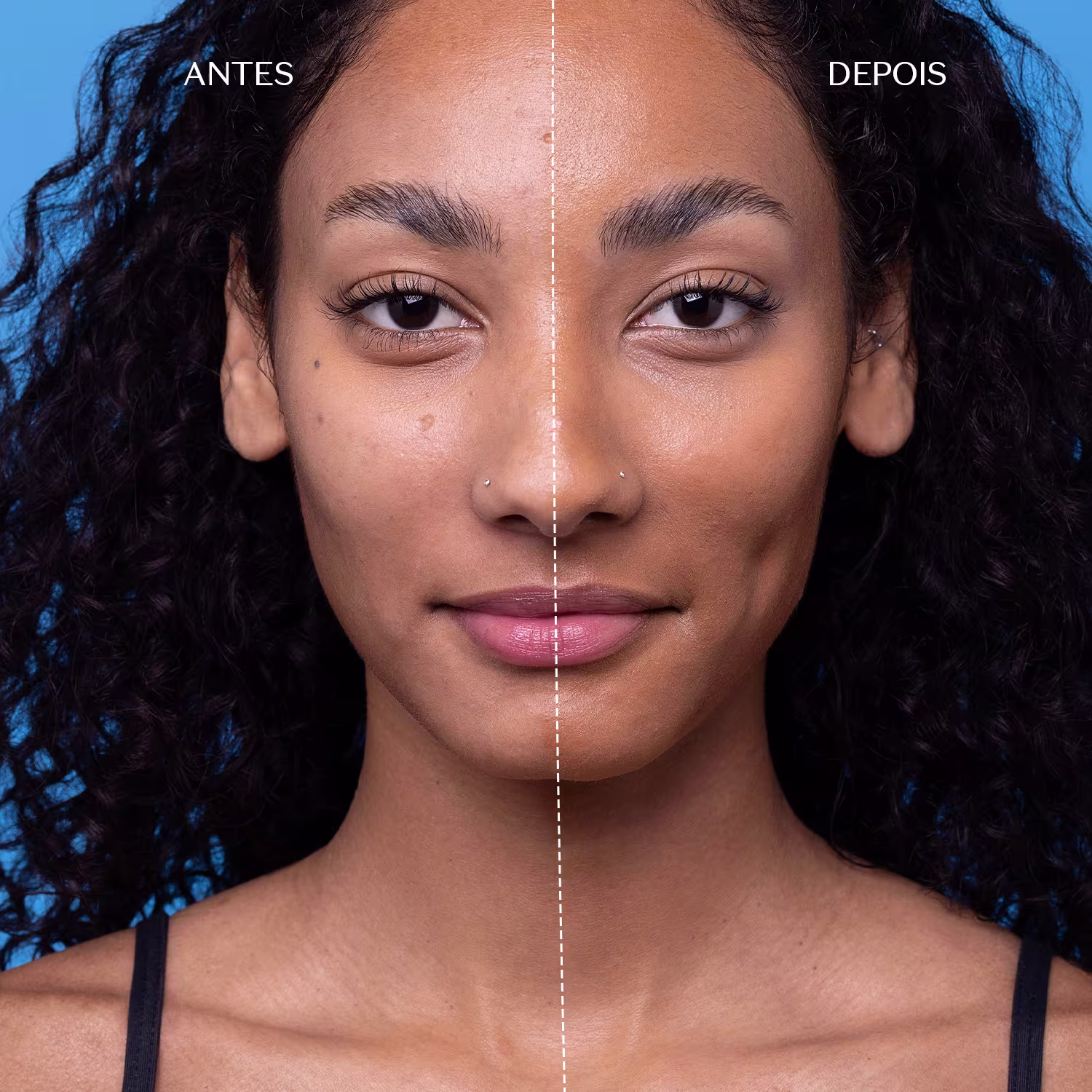 A imagem mostra uma mulher com cabelos escuros, olhando diretamente para a câmera. Há uma linha divisória vertical no centro da imagem, separando a aparência "antes" e "depois" de um tratamento de beleza. O fundo azul claro destaca o rosto da modelo.