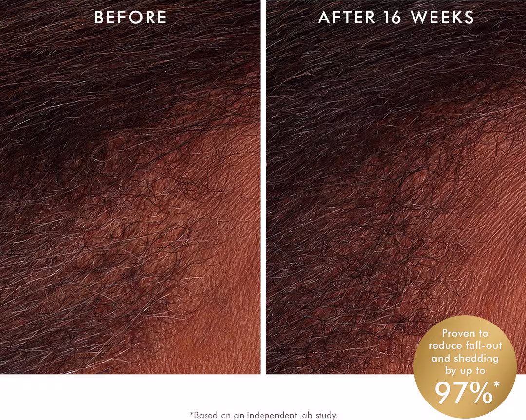 O produto Moroccanoil é apresentado em um contexto de antes e depois, mostrando a eficácia do tratamento para reduzir a queda de cabelo e o ressecamento em até 97%, com imagens de uma superfície de cabelo escuro e áspero antes e após 16 semanas de uso.