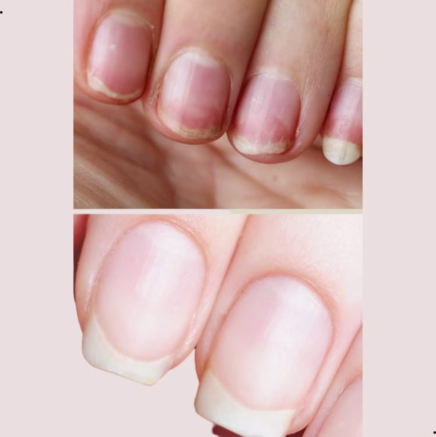 Base Niveladora para Unhas Abelha Rainha AR Tratamento, 9ml.