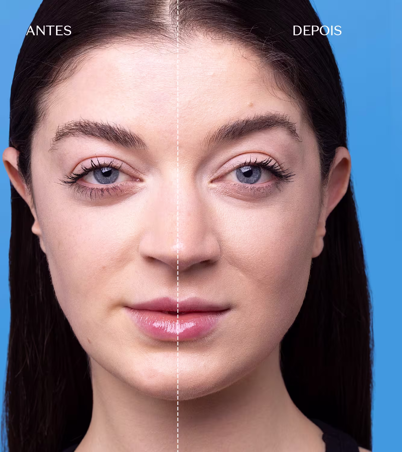 A imagem mostra uma mulher com cabelos escuros, olhando diretamente para a câmera. Há uma linha divisória vertical no centro da imagem, separando a aparência "antes" e "depois" de um tratamento de beleza. O fundo azul claro destaca o rosto da modelo.