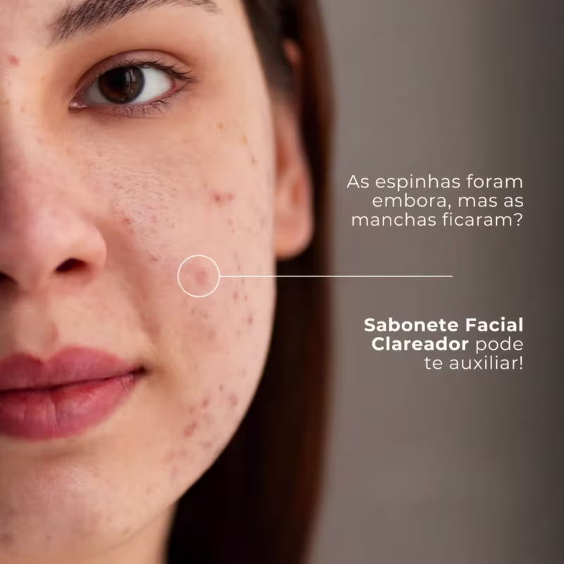 Kit Labotrat Sabonete Facial Clareador Água Micelar 250ml