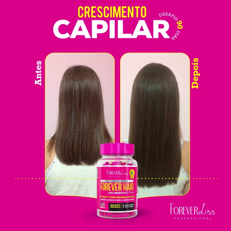 Combo Tratamento 3 Meses Forever Hair Crescimento Capilar