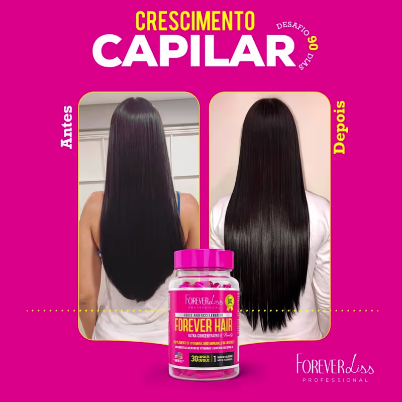 Combo Tratamento 12 Meses Forever Hair Crescimento Capilar