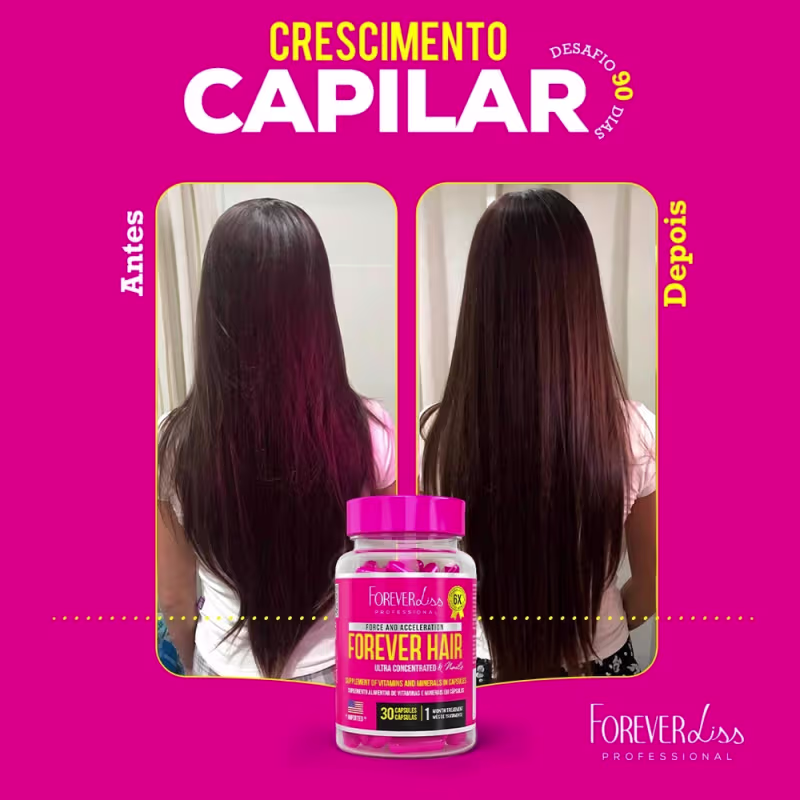 Combo Tratamento 3 Meses Forever Hair Crescimento Capilar - MKT