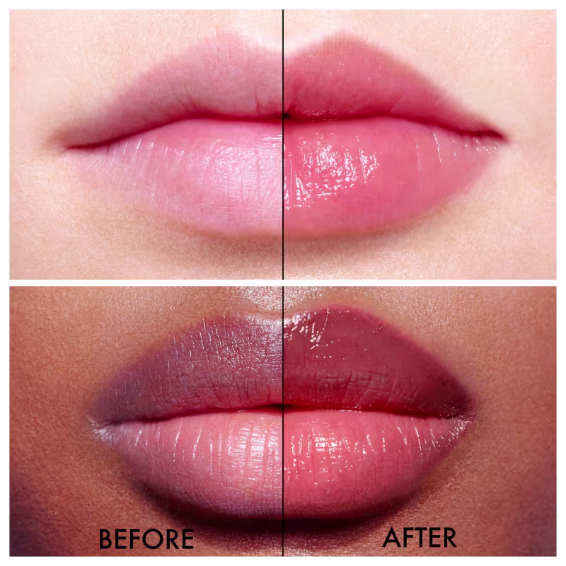 Antes e depois da aplicação do balm, sendo o depois com os lábios mais hidratados.