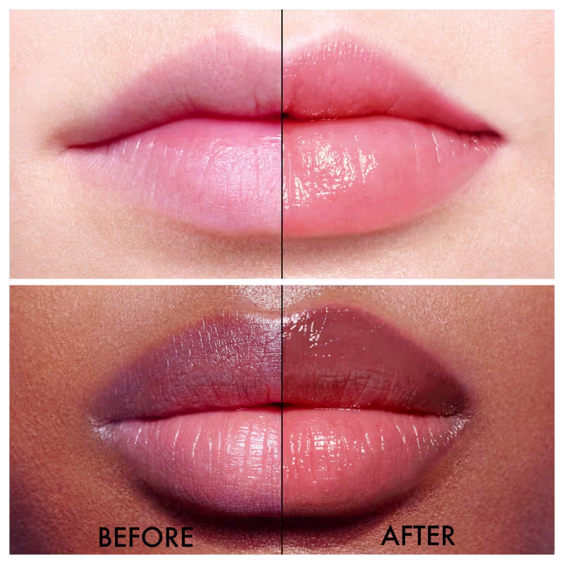 Antes e depois da aplicação do balm, sendo o depois com os lábios mais hidratados.