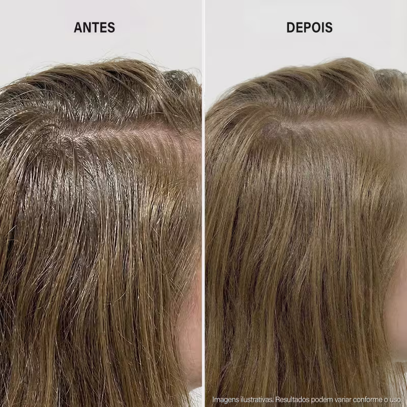 Frasco branco da linha Derma Regulate da Keune, com rótulo destacando o nome do produto e a indicação de que se trata de um shampoo regulador de sebo.