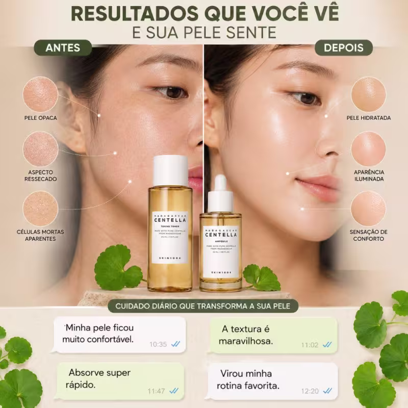 Kit Skin1004 Madagascar Centella: Tônico Facial 210ml e Ampoula 55ml
